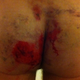 Illustration for article titled My Severely Busted Ass Is Why You Dont Wear Jeans On A Motorcycle